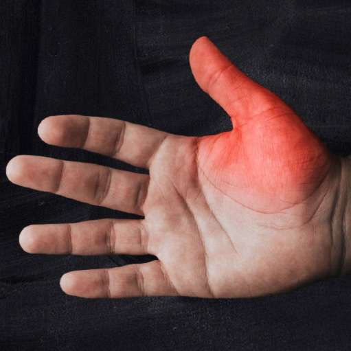 STICK OUT LIKE A SORE THUMB
